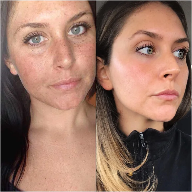ANTHELIOS UVMUNE 400 OIL CONTROL FLUIDO SPF50+