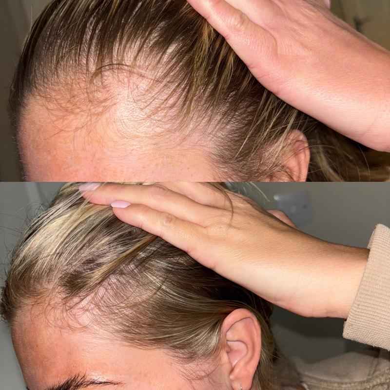 The Ordinary Multi-Peptide Serum for Hair Density