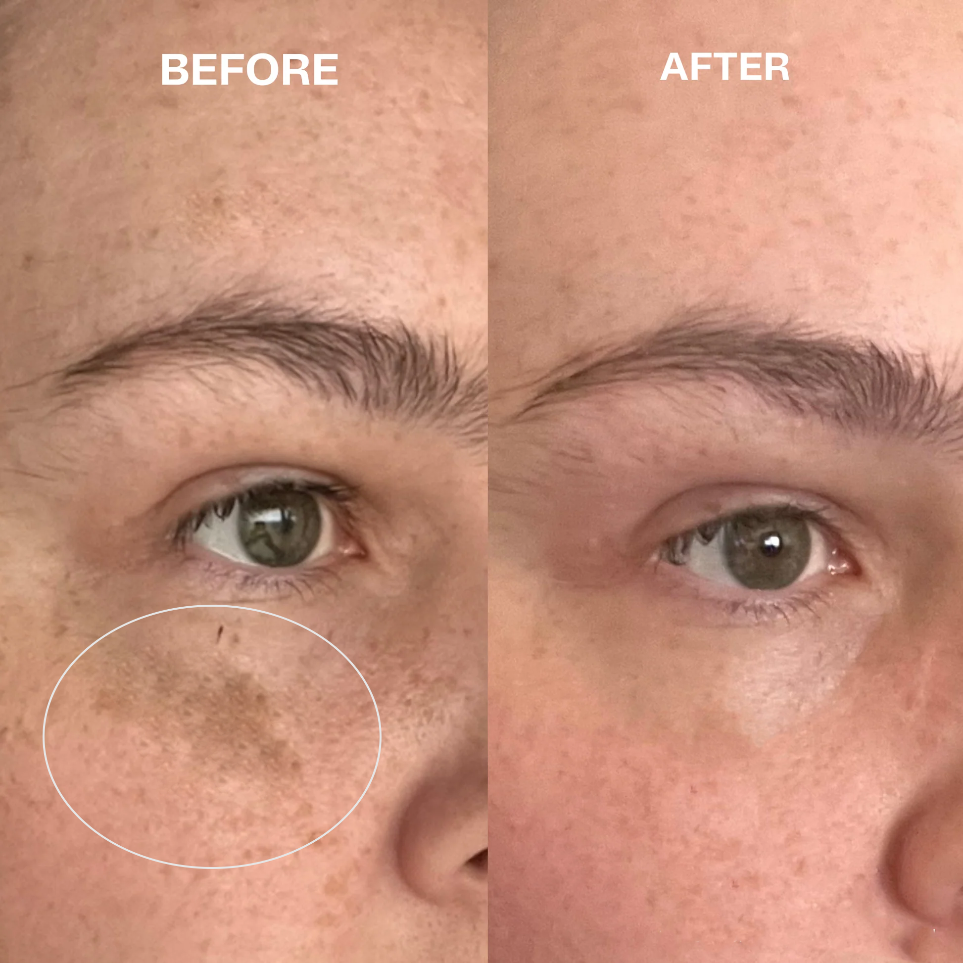 The Ordinary Serum Vitamina C Ascorbic Acid 8% Alpha Arbutin 2% 30ml