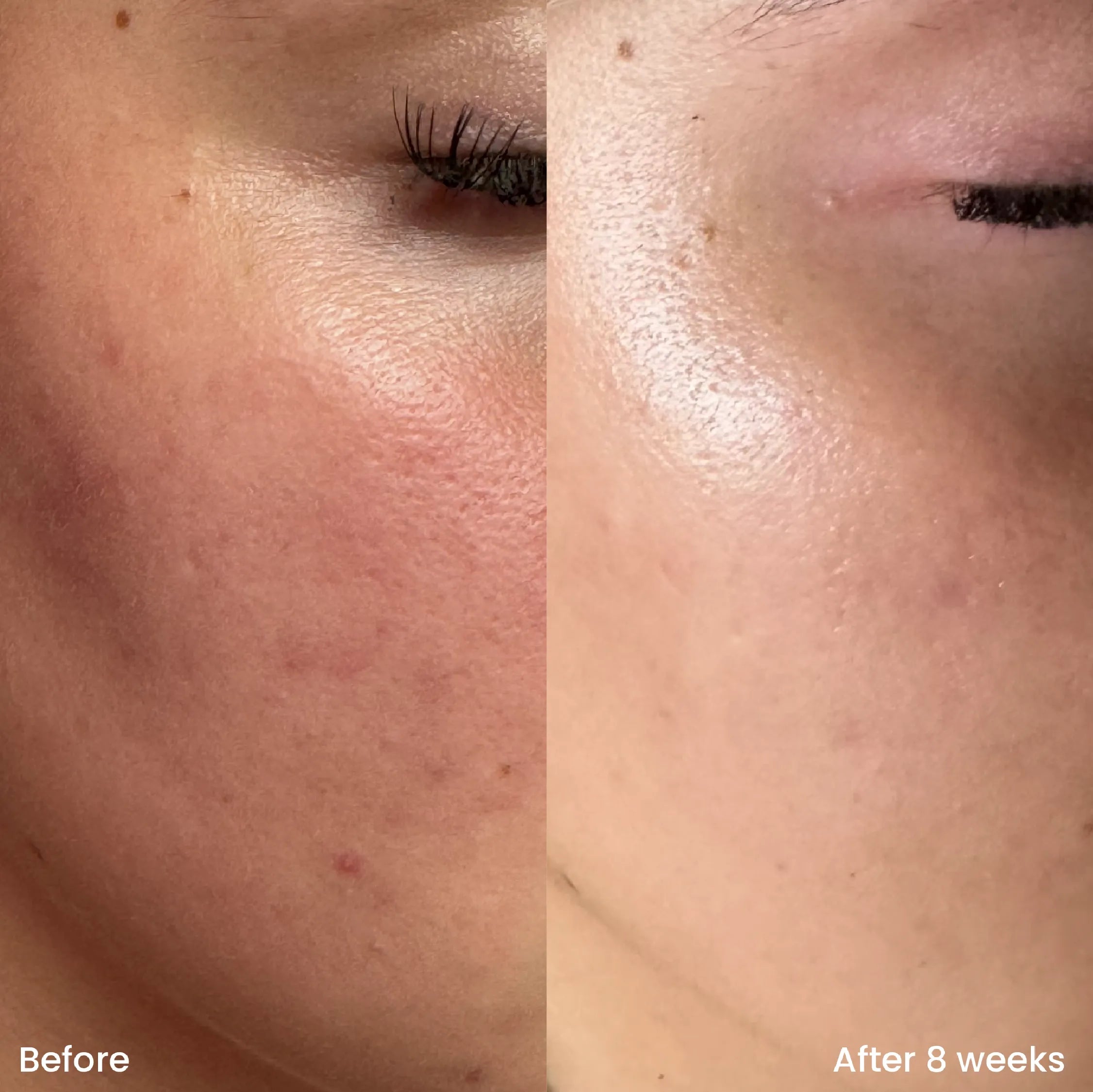 Dúo Ordinary: Natural moisturizing factors + ha y Niacinamida 10% + Zinc 1%