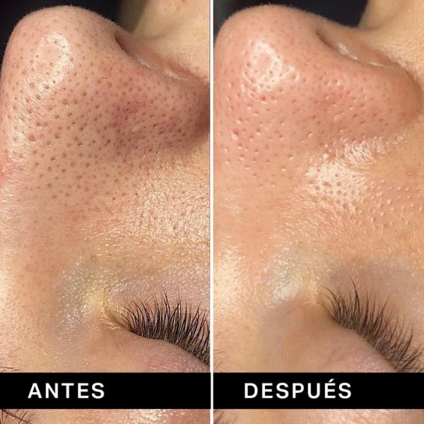 Dúo Ordinary: Natural moisturizing factors + ha y Niacinamida 10% + Zinc 1%