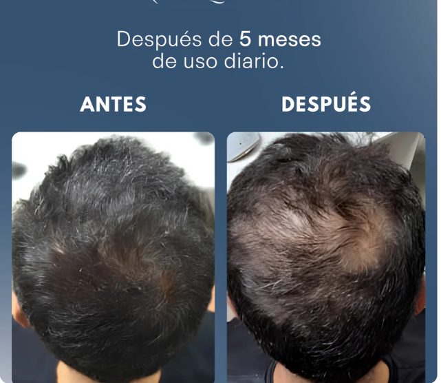 SHAMPOO EXCALVO