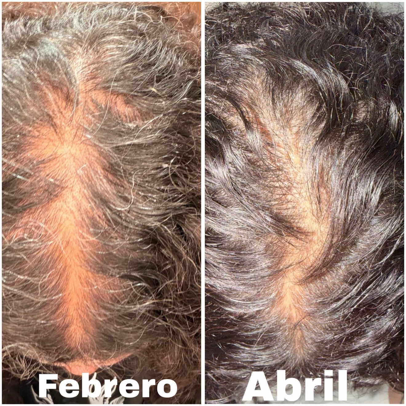 Suero Multipeptídico para Densidad Capilar de The Ordinary