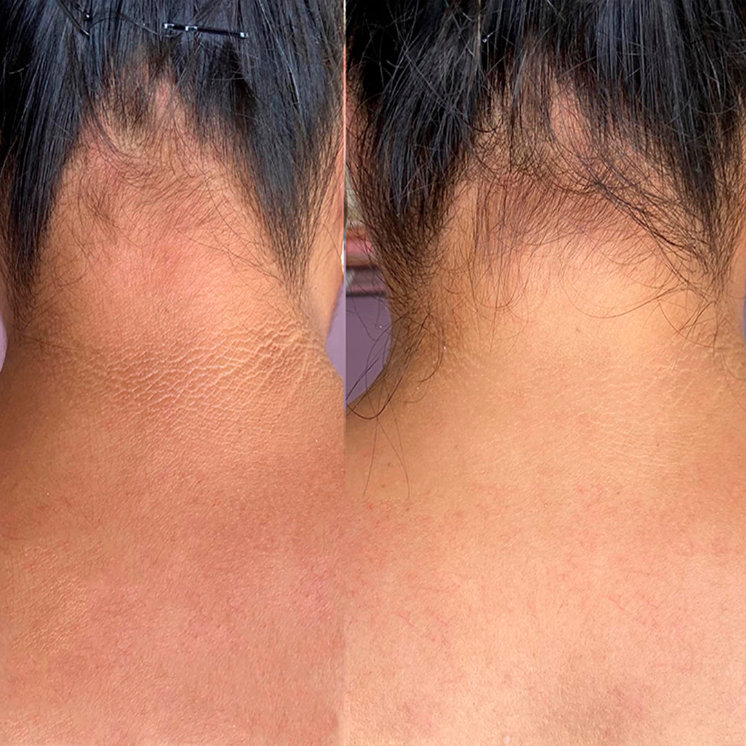 The Ordinary Solución Tónica de Ácido Glicólico 7% para Piel Radiante