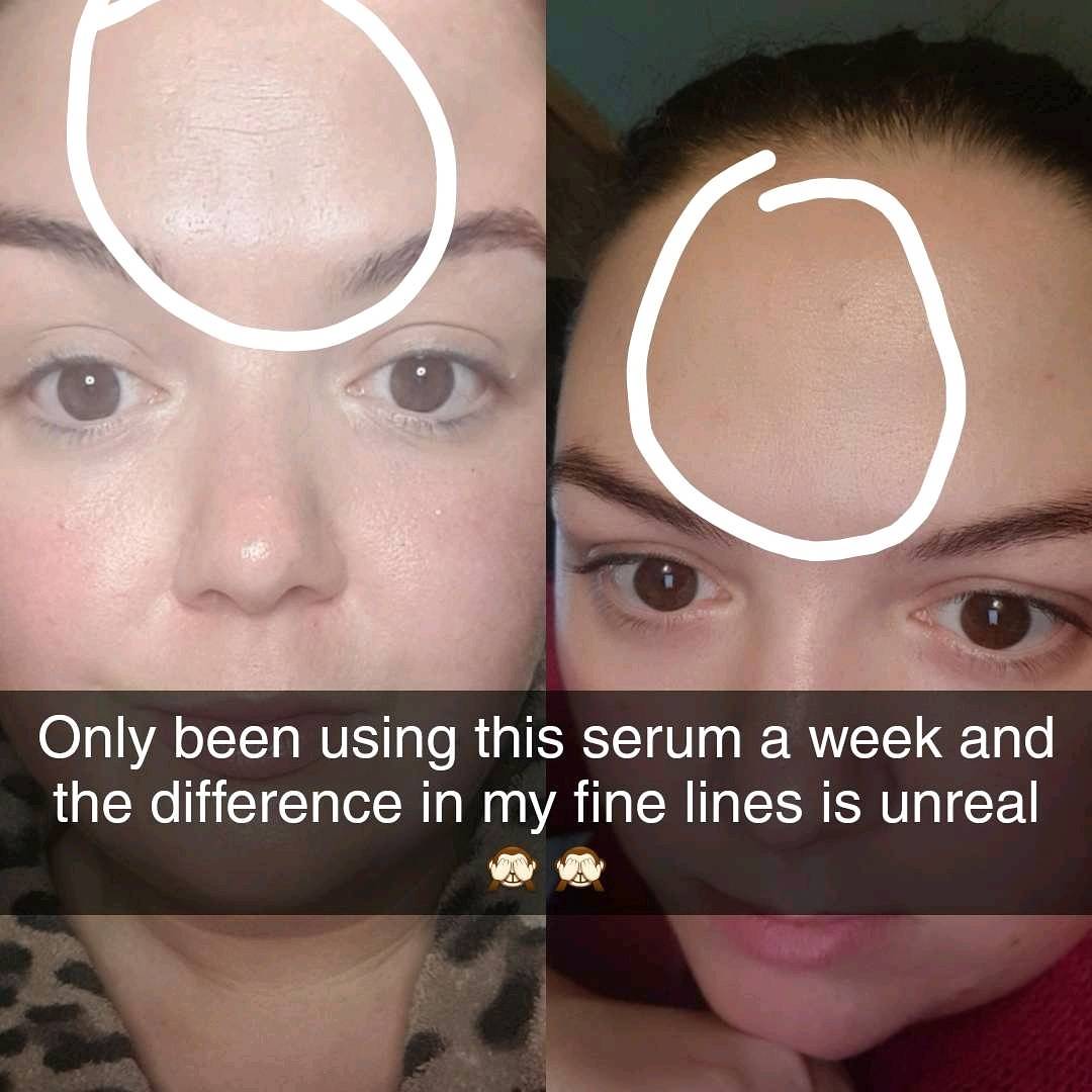 The Ordinary sérum Matrixyl 10% + HA